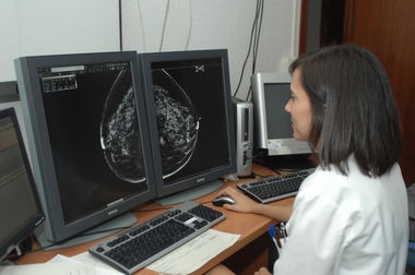 El Hospital San Pedro de Alcántara de Cáceres participa en un estudio sobre la quimioterapia ante cáncer de mama