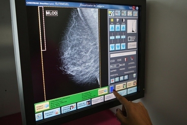 Casi 7.000 extremeñas se someterán a mamografías en junio dentro del Programa de Detección Precoz del Cáncer de Mama