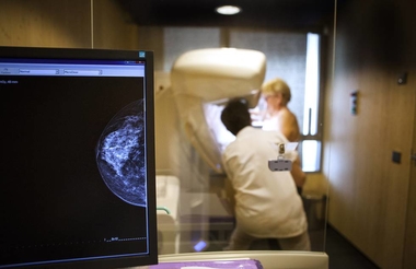 Unas 4.500 extremeñas se someterán a mamografías en diciembre dentro del Programa de Detección Precoz del Cáncer de Mama