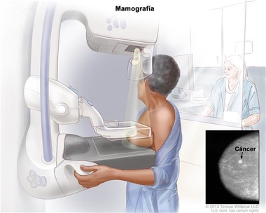 Más de 7.600 extremeñas se someterán a mamografías en mayo dentro del Programa de Detección Precoz del Cáncer de Mama